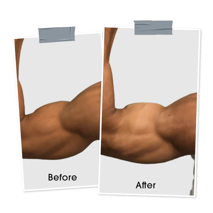 Niconi Men Enzyme De Tan Pack For Face And Body 300g Best Quality Skincare Solution